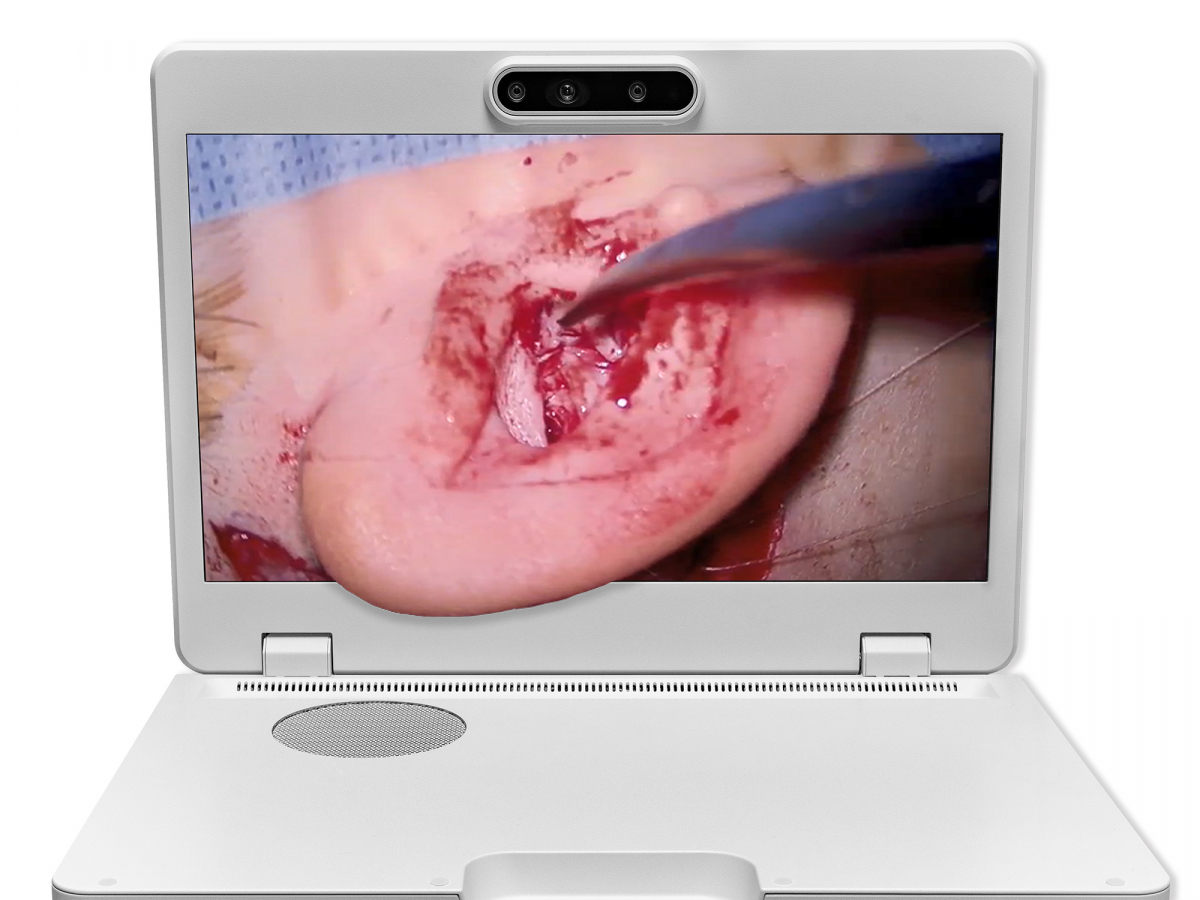 ����֮��Heads-up 3D��΢������ʾϵͳ��������4K����3D��ʾ������׷��ϵͳ���߱�����׷�������ƶ�λ�ù��ܣ�����ҽʦ��ʱ��ά�̶ֹ����Ƶĸ�������ҽʦ���и�����������3D������Ұ�������ʵ�������ִ��������